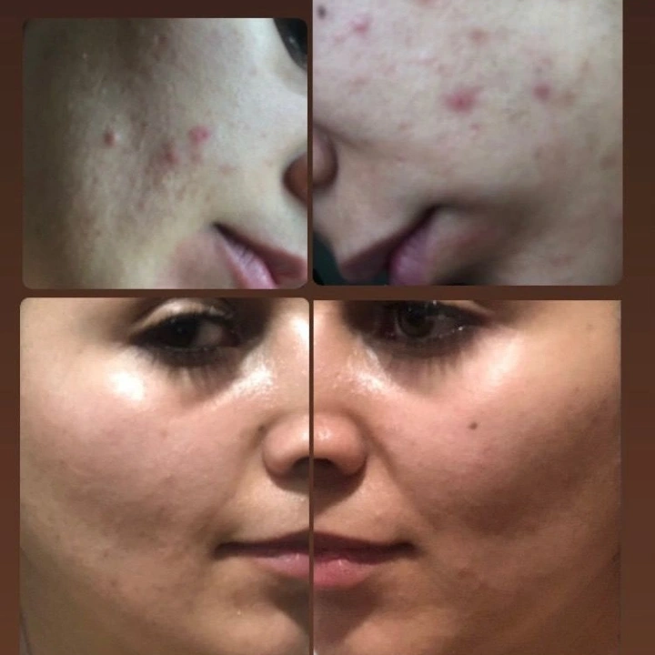 نمونه کار مژگان صالحی — لیفت و لمینت مژه