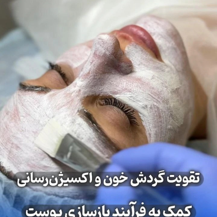 نمونه کار مژگان صالحی — لیفت و لمینت مژه