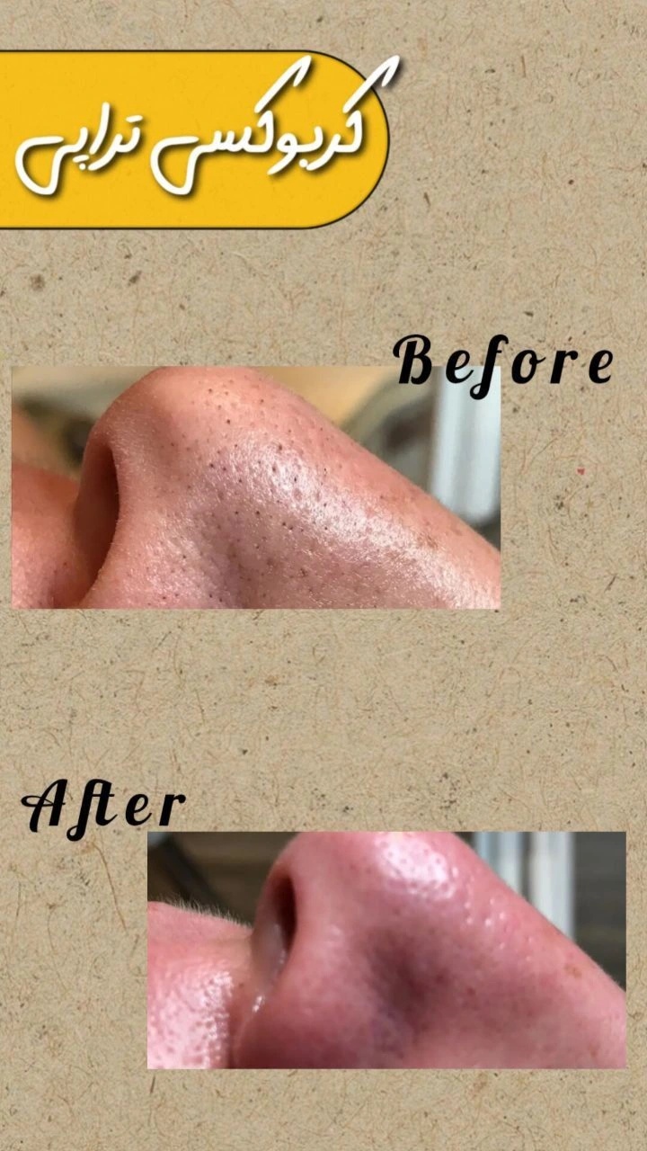 نمونه کار مژگان صالحی — لیفت و لمینت مژه