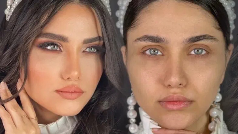 نمونه کار مژده زرین فرد — لیفت و لمینت مژه