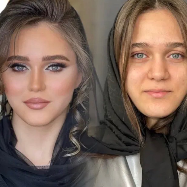 نمونه کار مژده زرین فرد — لیفت و لمینت مژه