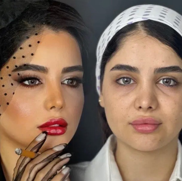 نمونه کار مژده زرین فرد — لیفت و لمینت مژه