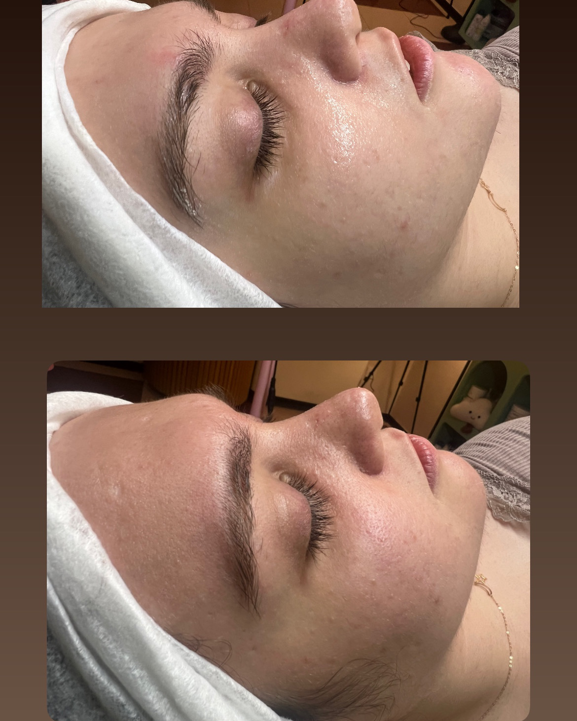 نمونه کار متین مهاجری — لیفت و لمینت مژه