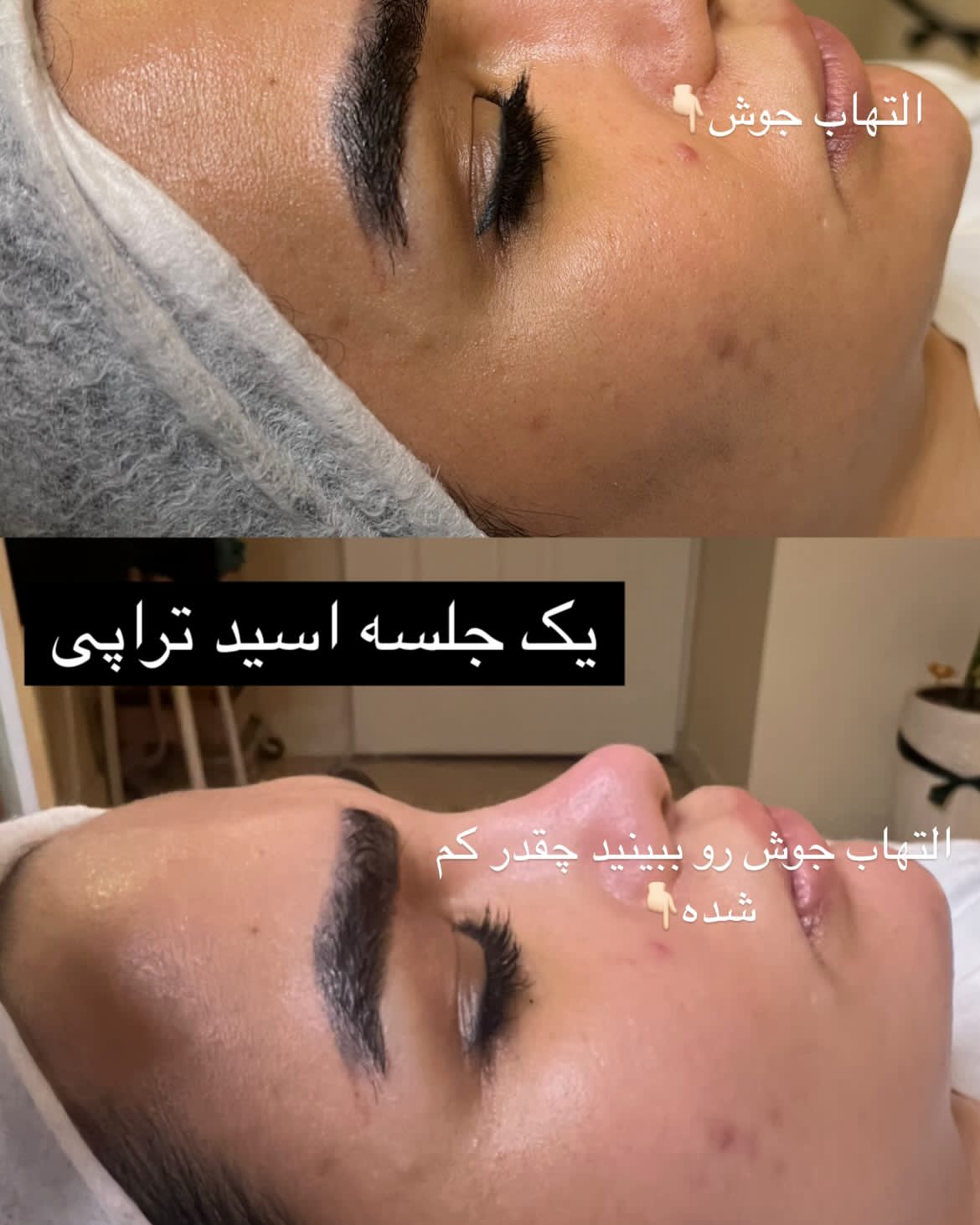 نمونه کار متین مهاجری — لیفت و لمینت مژه