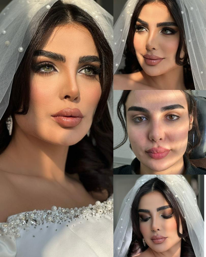 نمونه کار محیا باقری — لیفت و لمینت مژه