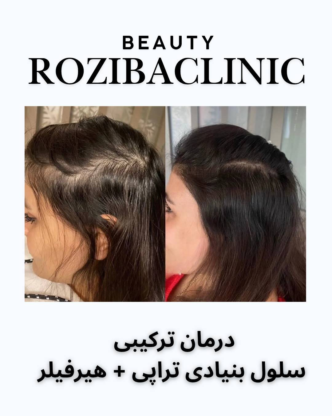 نمونه کار معصومه محمودی — لیفت و لمینت مژه