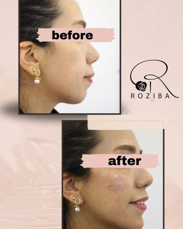 نمونه کار معصومه محمودی — لیفت و لمینت مژه