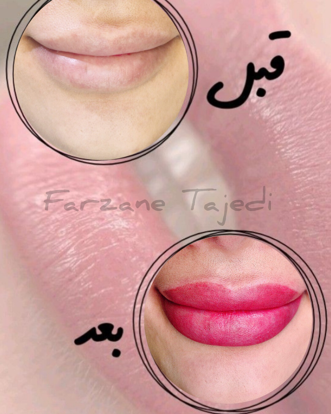 نمونه کار فرزانه تاجدی — لیفت و لمینت مژه