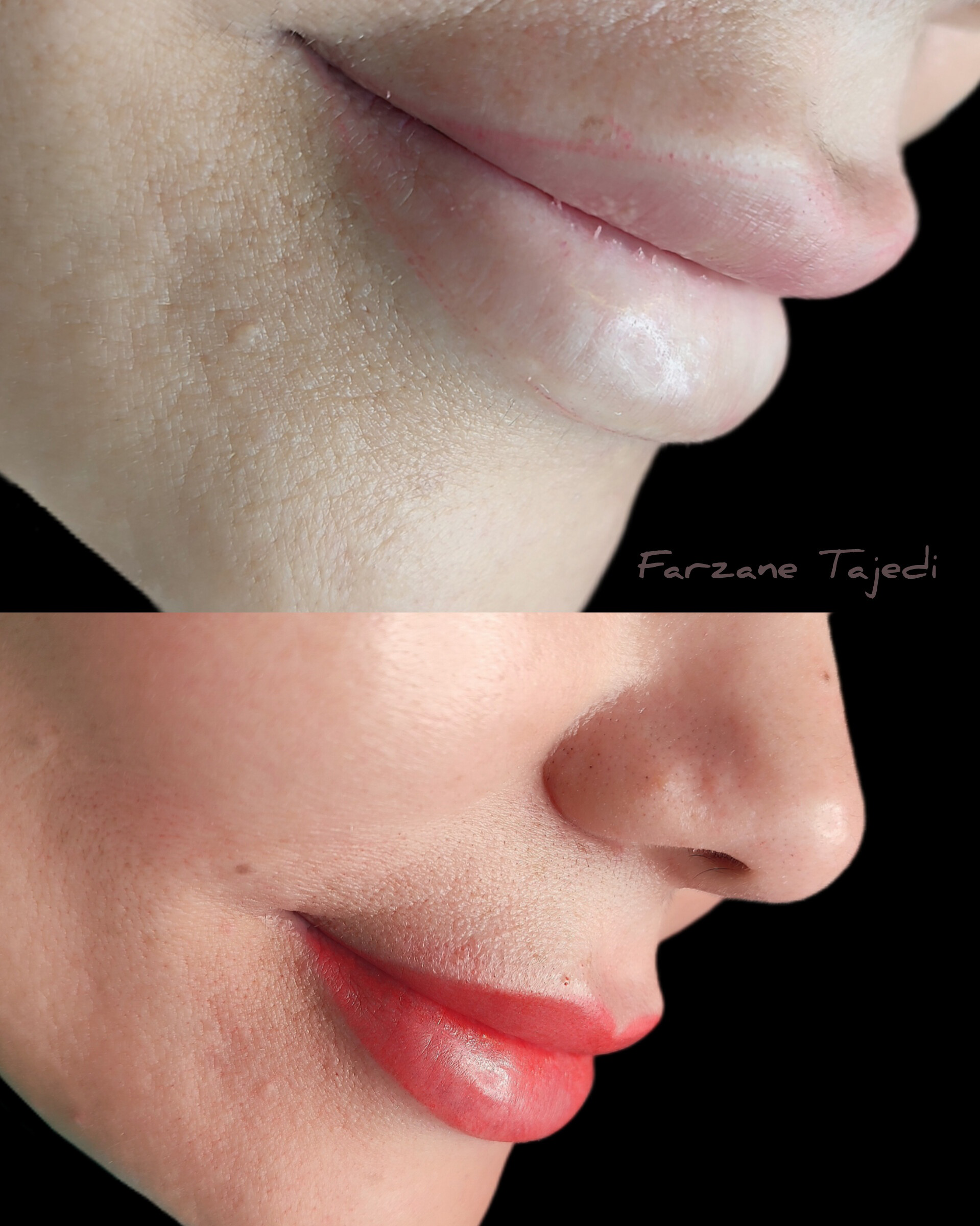 نمونه کار فرزانه تاجدی — لیفت و لمینت مژه