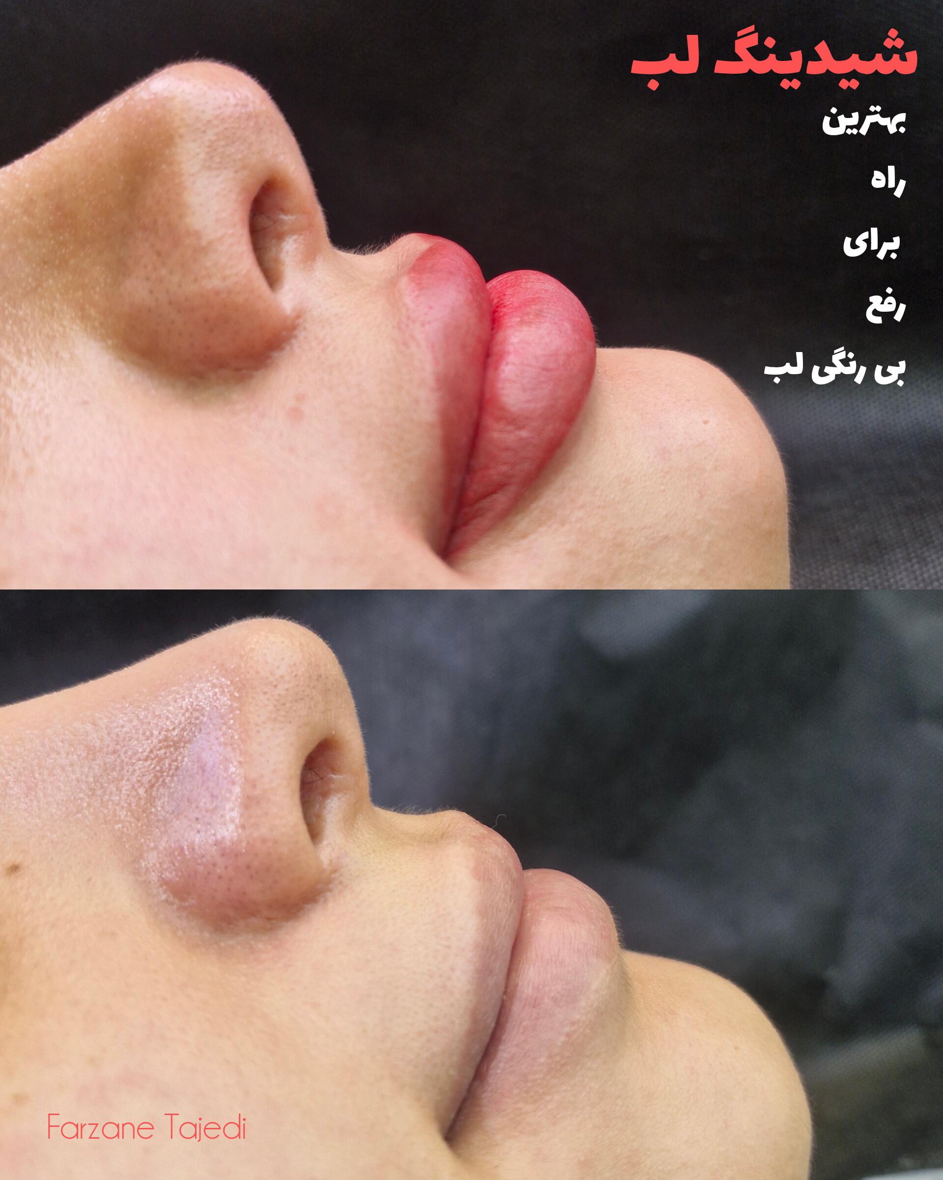 نمونه کار فرزانه تاجدی — لیفت و لمینت مژه