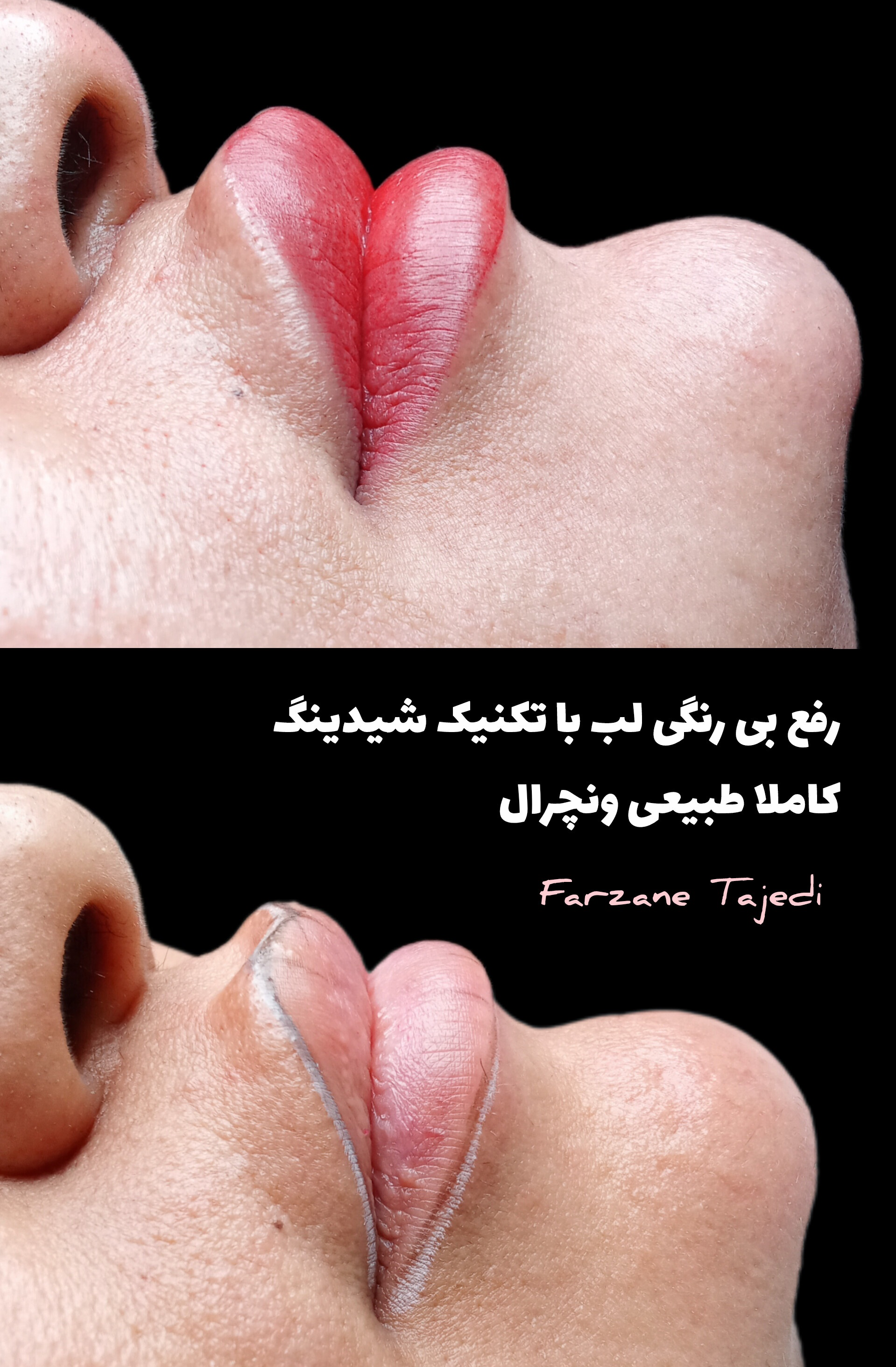 نمونه کار فرزانه تاجدی — لیفت و لمینت مژه