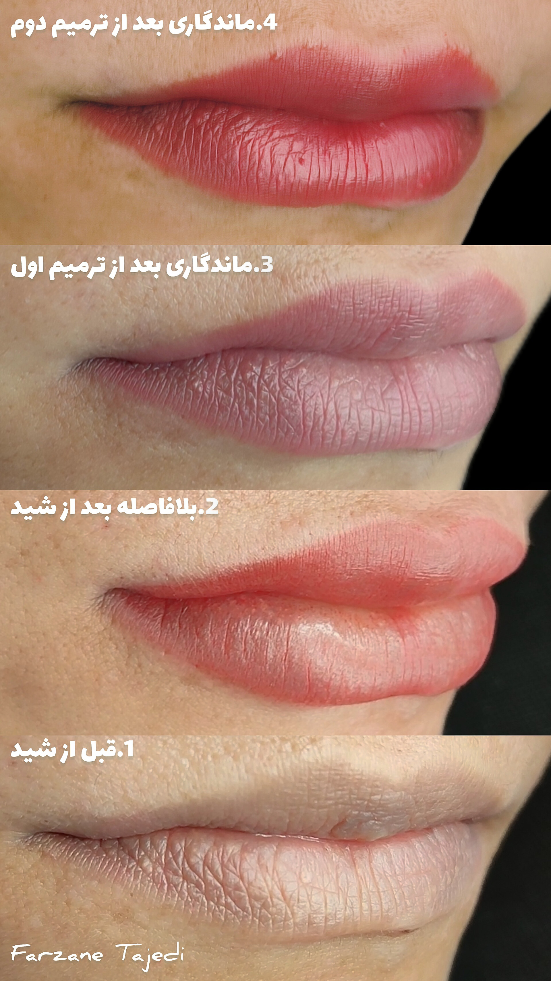 نمونه کار فرزانه تاجدی — لیفت و لمینت مژه