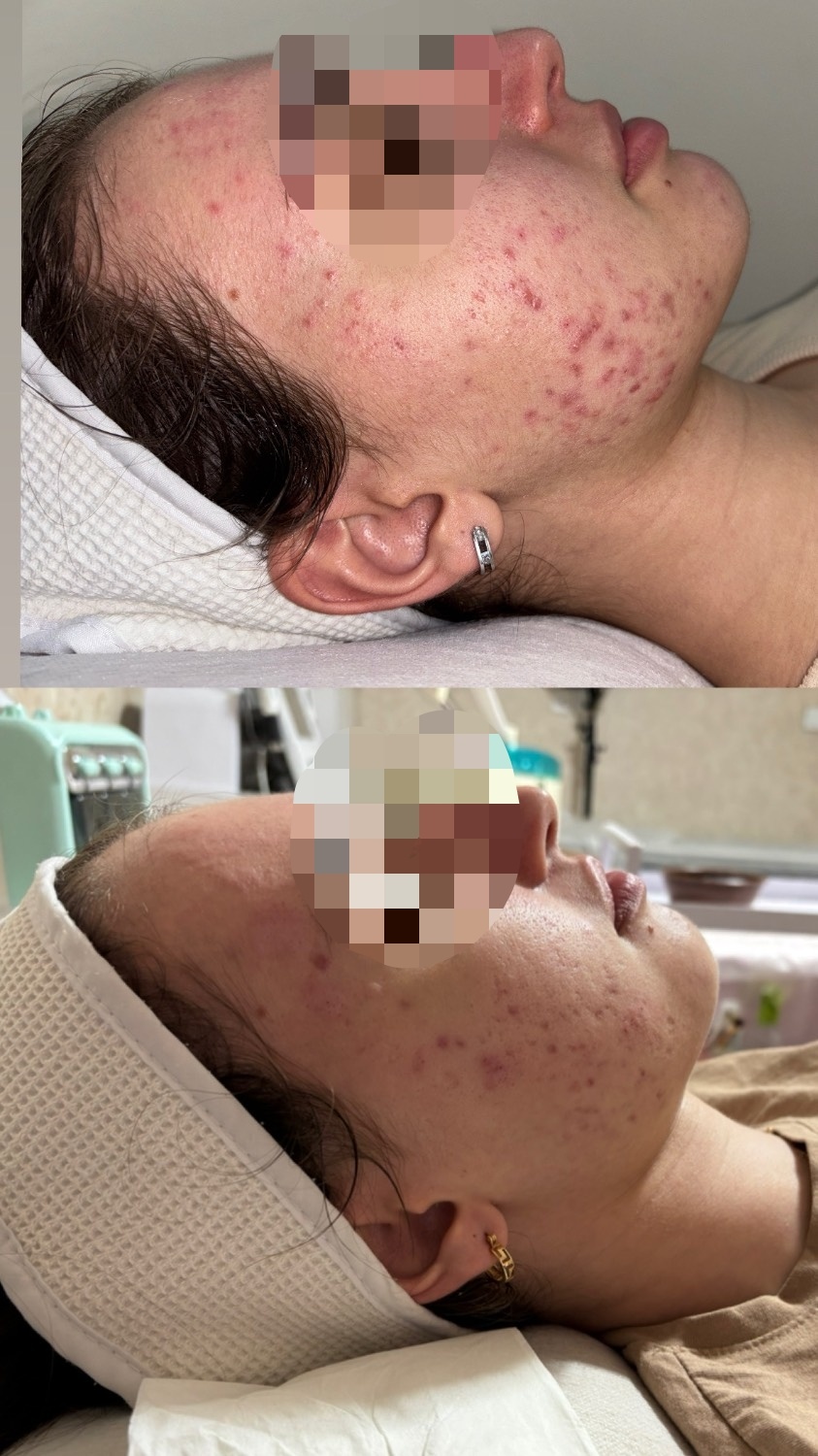 نمونه کار مرجان فضلی — لیفت و لمینت مژه