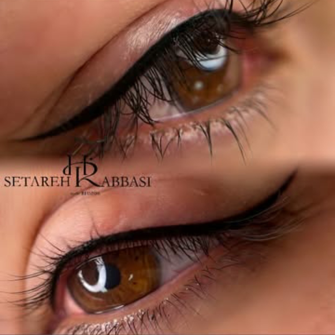 نمونه کار ستاره عباسی — لیفت و لمینت مژه
