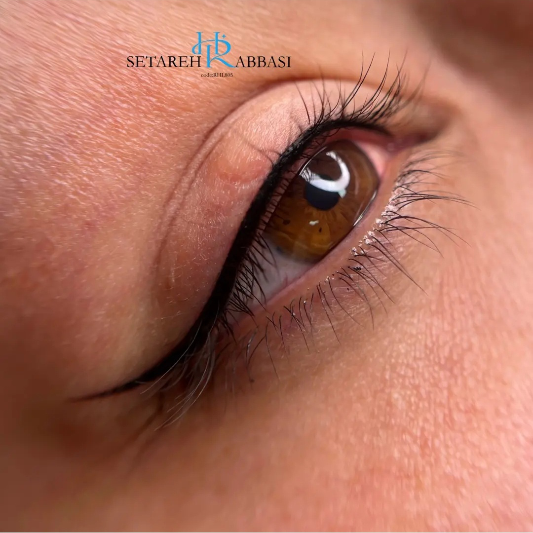 نمونه کار ستاره عباسی — لیفت و لمینت مژه