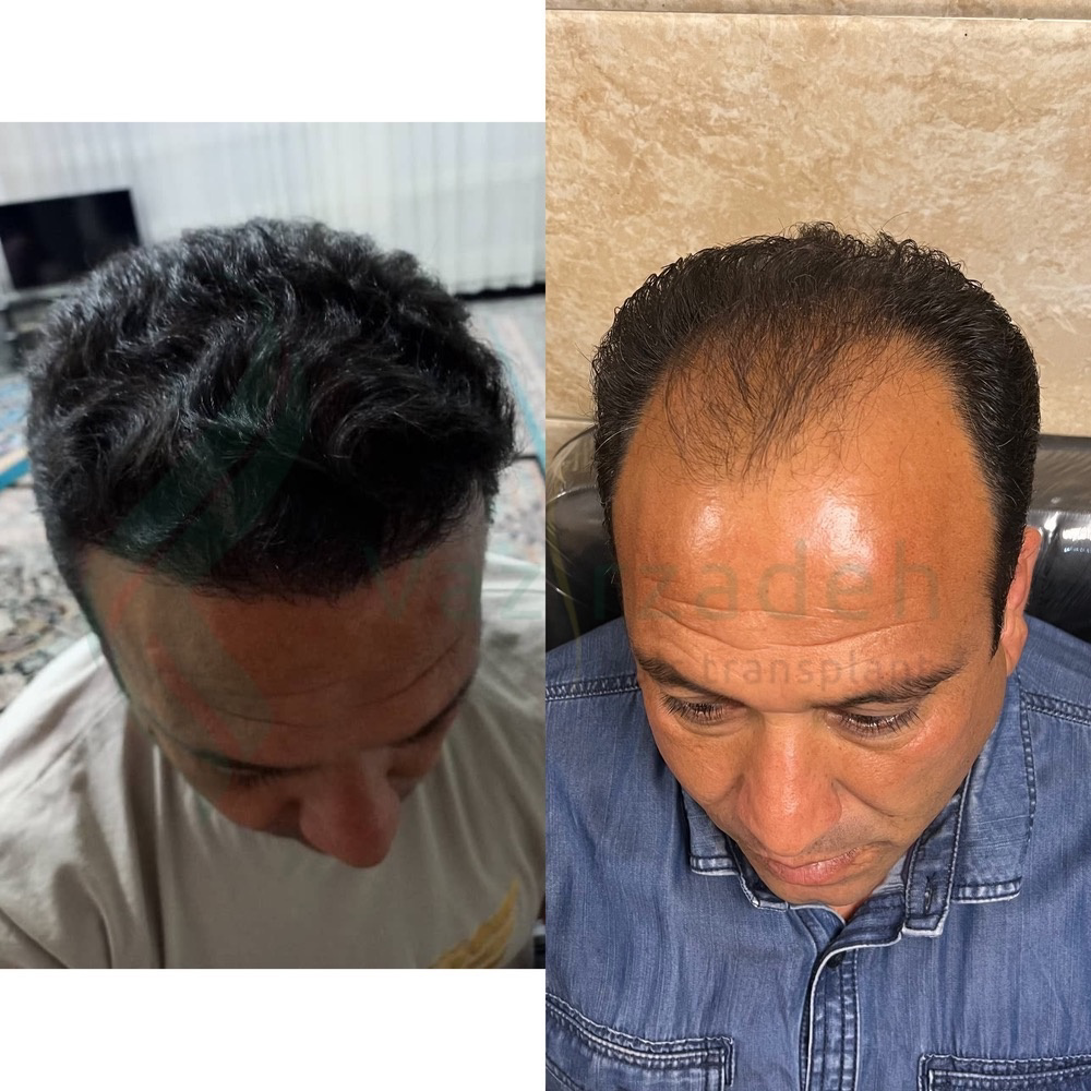 نمونه کار مینا وزیرزاده — لیفت و لمینت مژه