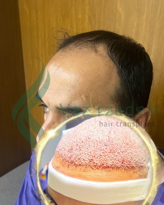 نمونه کار مینا وزیرزاده — لیفت و لمینت مژه