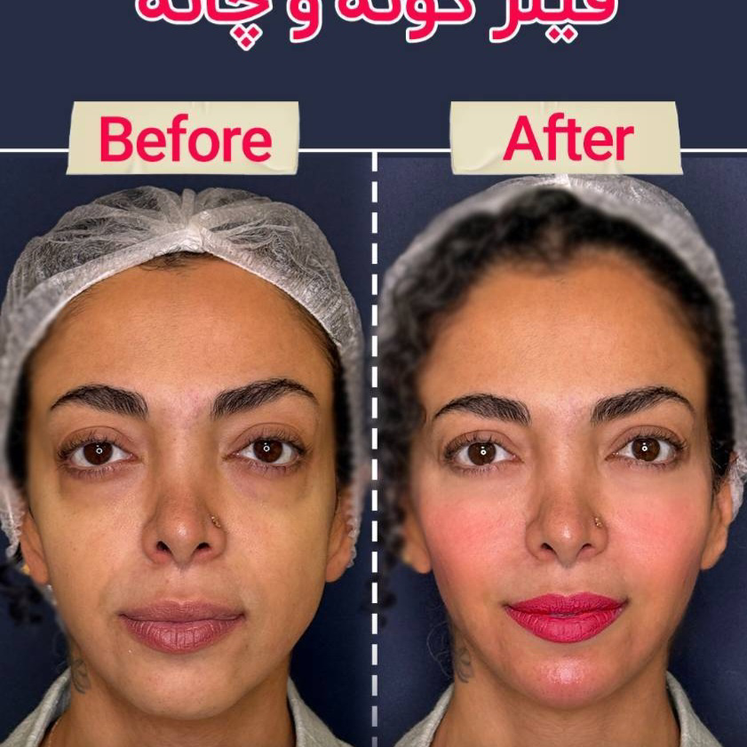 نمونه کار پریسا نجیب نژاد — لیفت و لمینت مژه