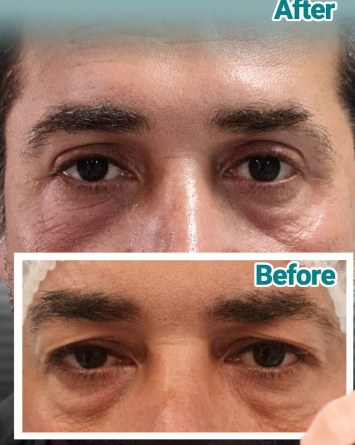 نمونه کار پریسا نجیب نژاد — لیفت و لمینت مژه