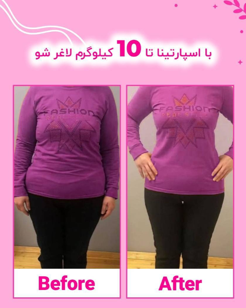 نمونه کار پریسا نجیب نژاد — لیفت و لمینت مژه