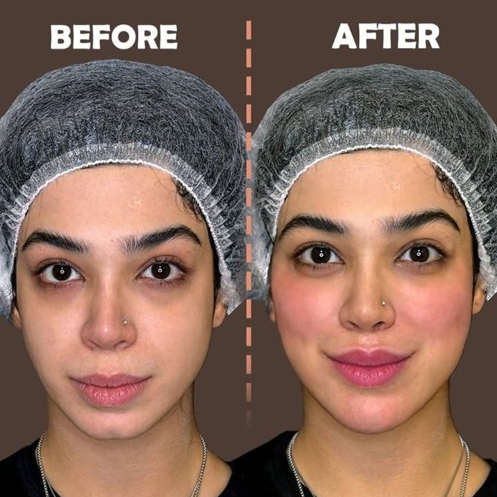 نمونه کار پریسا نجیب نژاد — لیفت و لمینت مژه