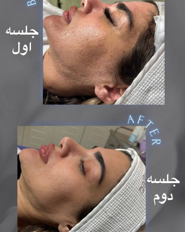 نمونه کار پریسا نجیب نژاد — لیفت و لمینت مژه