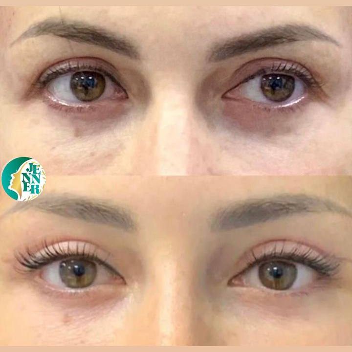نمونه کار پریسا نجیب نژاد — لیفت و لمینت مژه