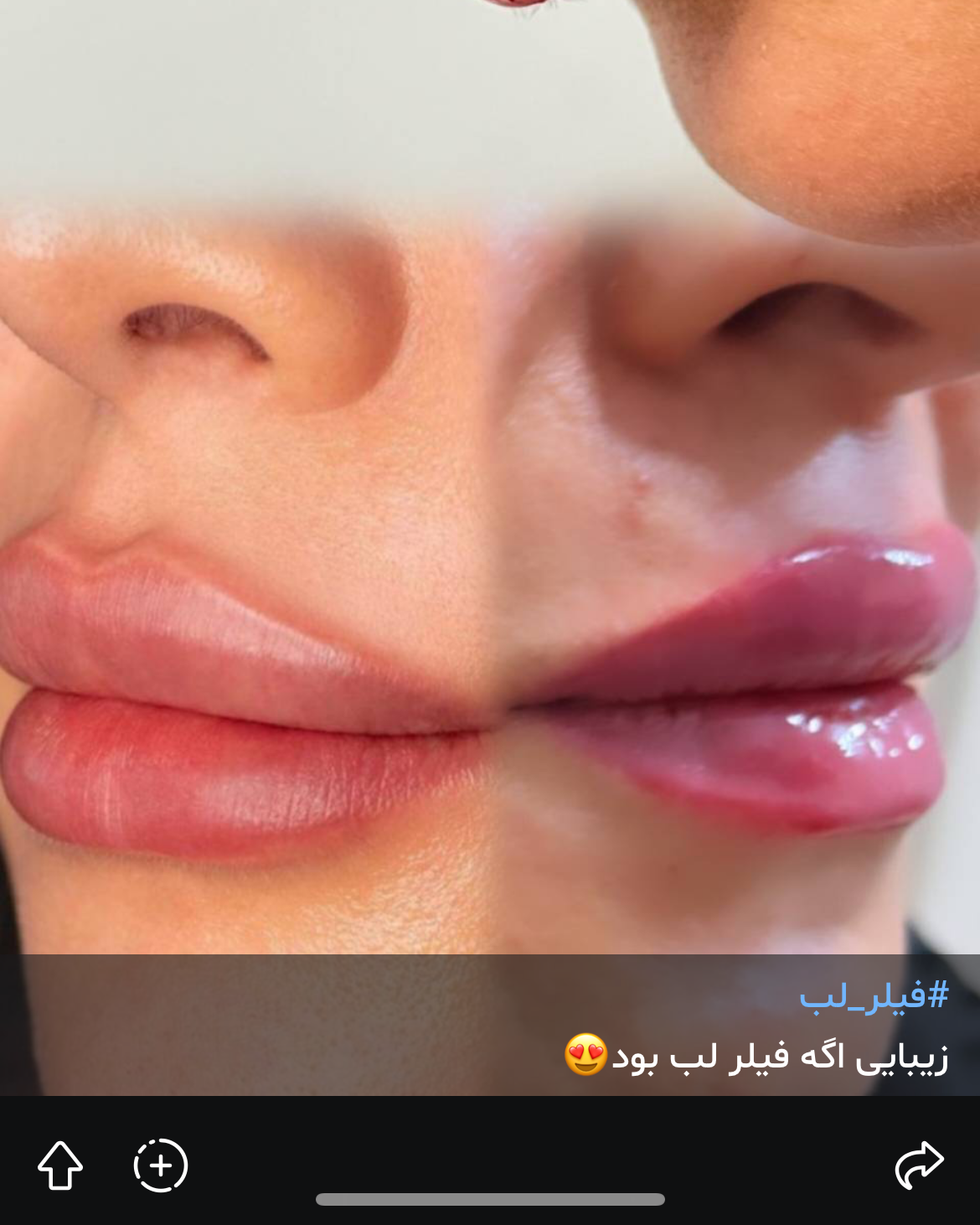 نمونه کار مهشید ذاکری — لیفت و لمینت مژه