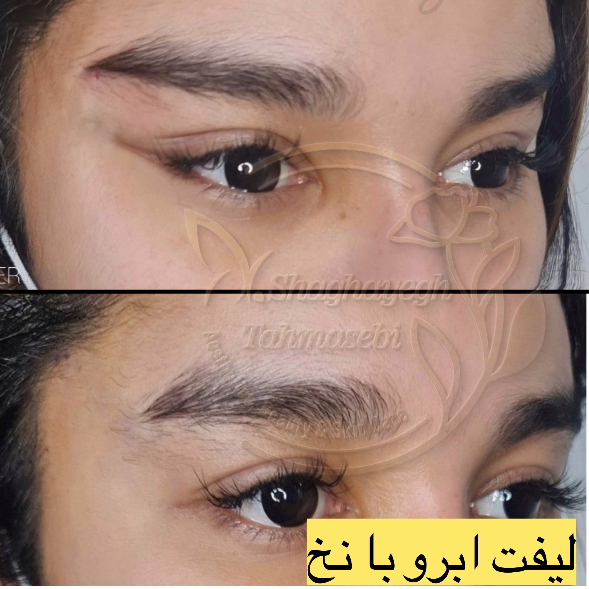 نمونه کار دکتر شقایق طهماسبی — لیفت و لمینت مژه