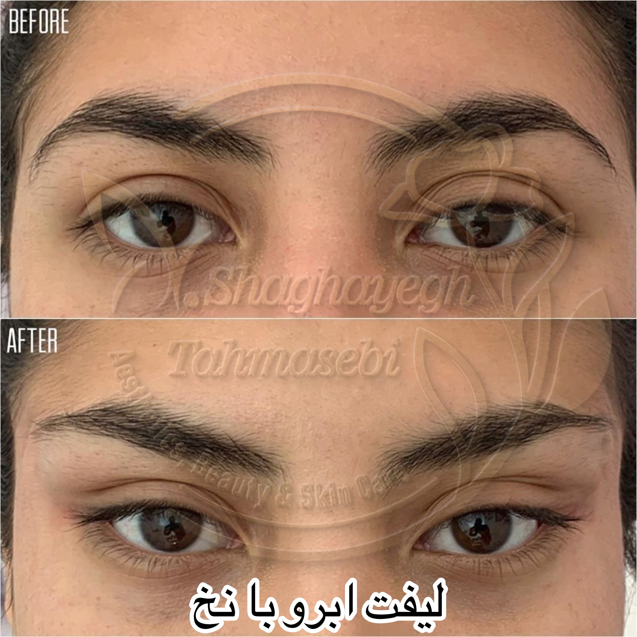 نمونه کار دکتر شقایق طهماسبی — لیفت و لمینت مژه