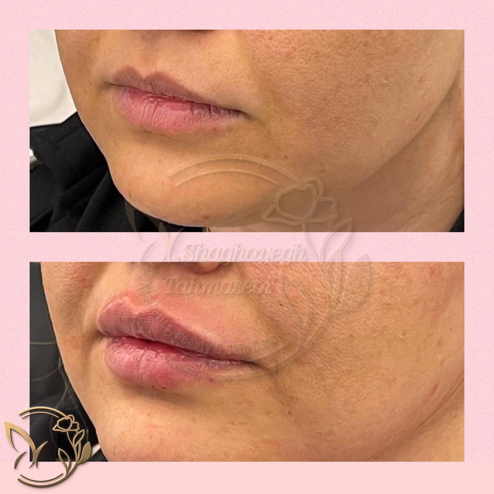 نمونه کار دکتر شقایق طهماسبی — لیفت و لمینت مژه