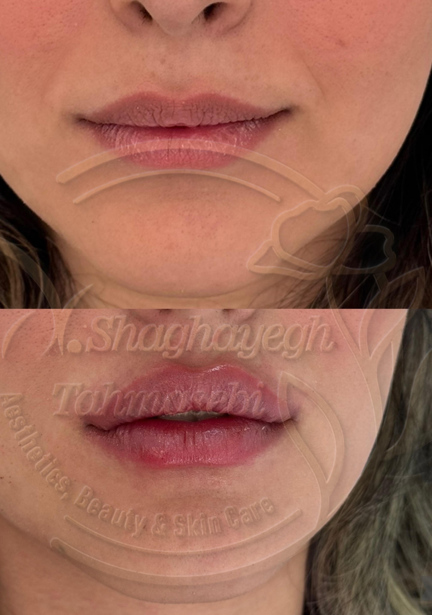 نمونه کار دکتر شقایق طهماسبی — لیفت و لمینت مژه