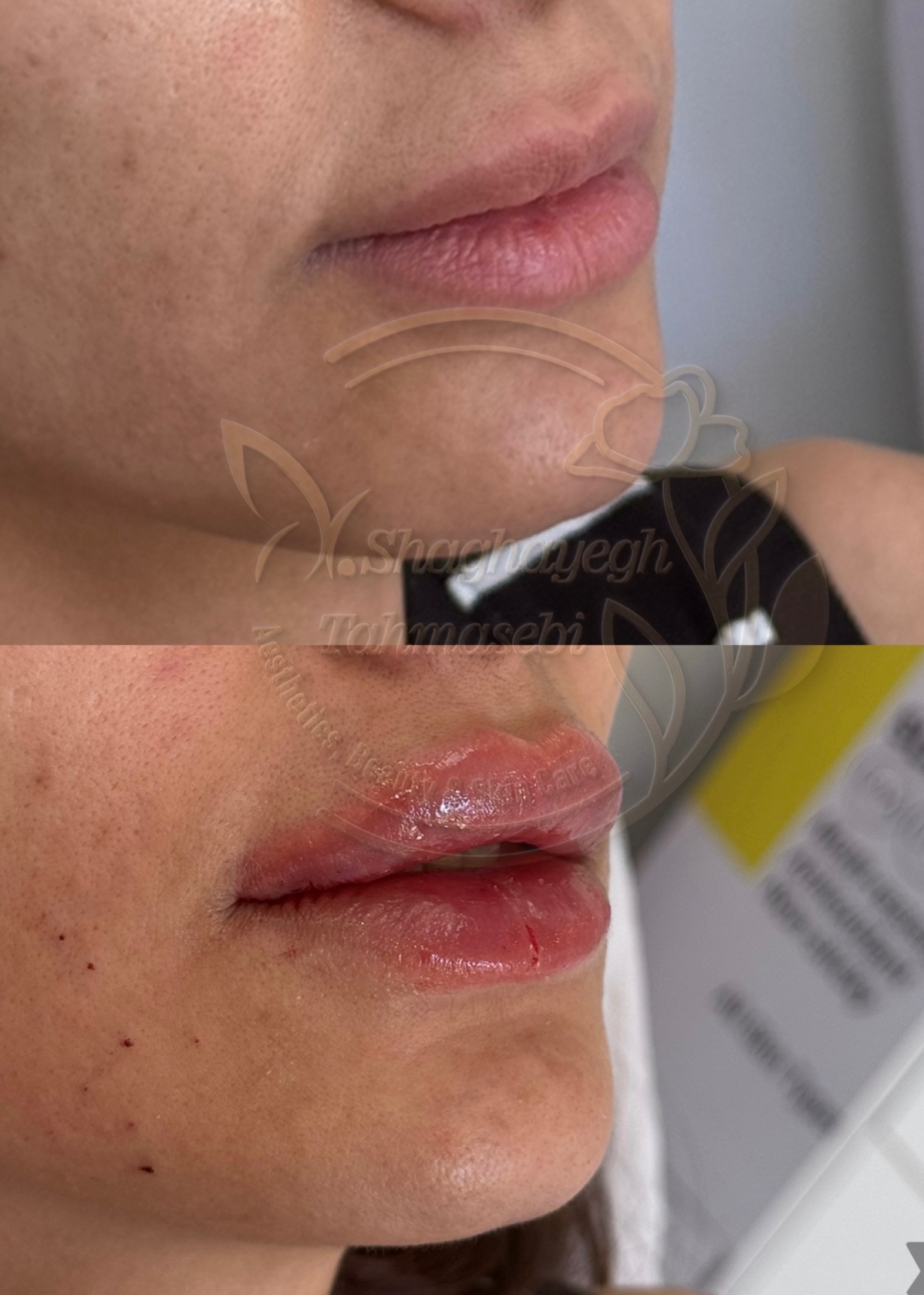 نمونه کار دکتر شقایق طهماسبی — لیفت و لمینت مژه