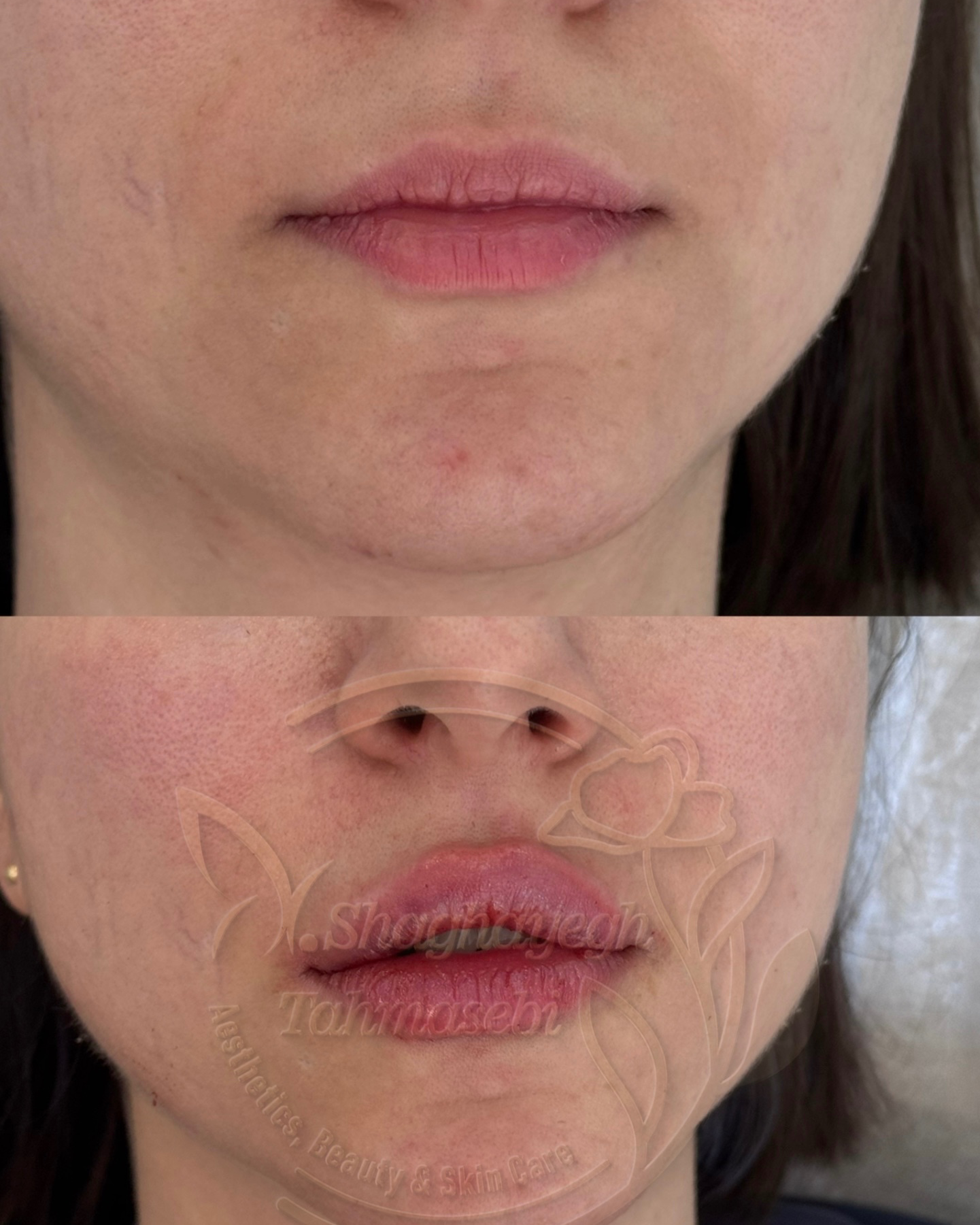 نمونه کار دکتر شقایق طهماسبی — لیفت و لمینت مژه