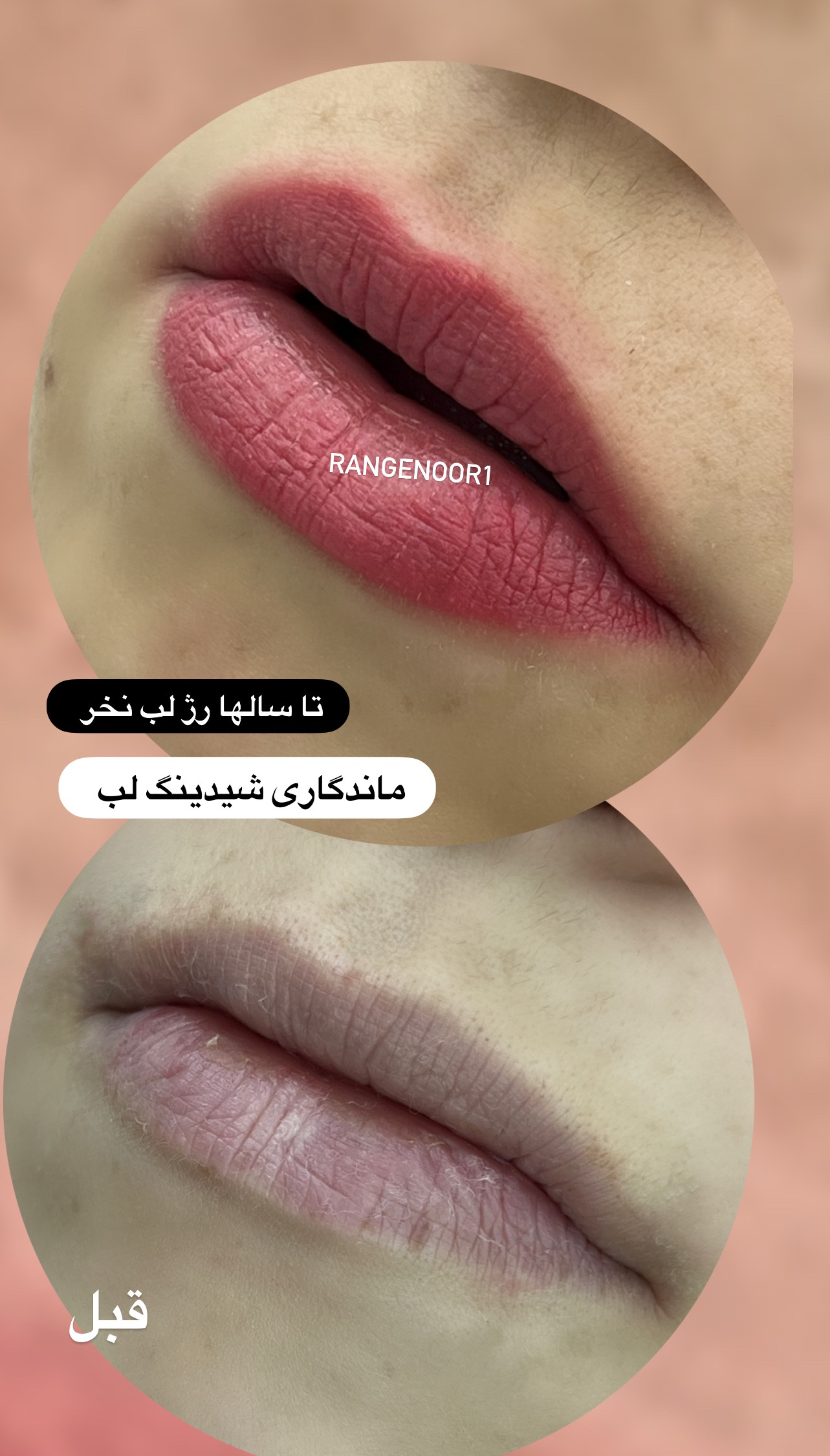 نمونه کار پروانه تقی پور — لیفت و لمینت مژه