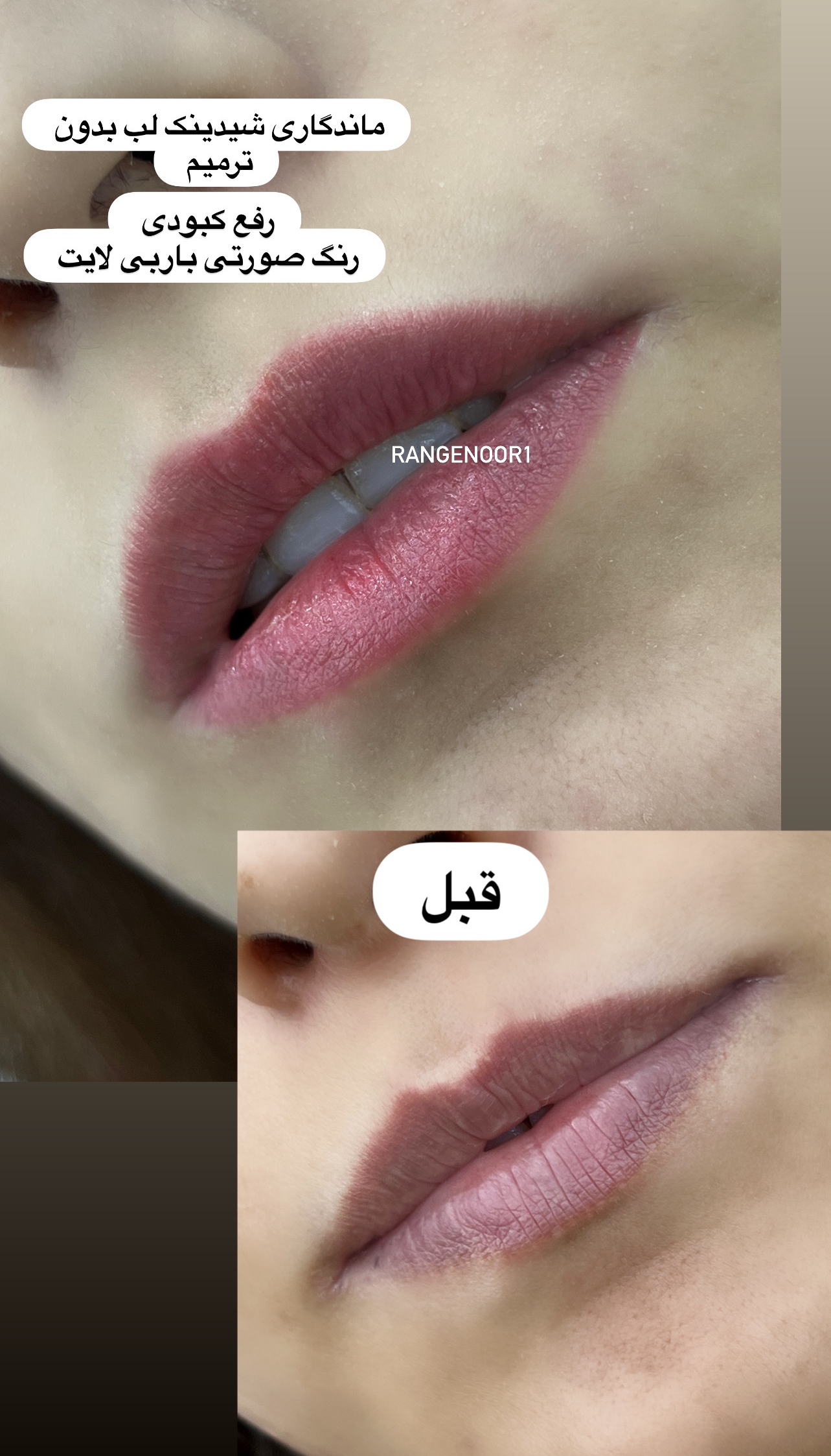 نمونه کار پروانه تقی پور — لیفت و لمینت مژه