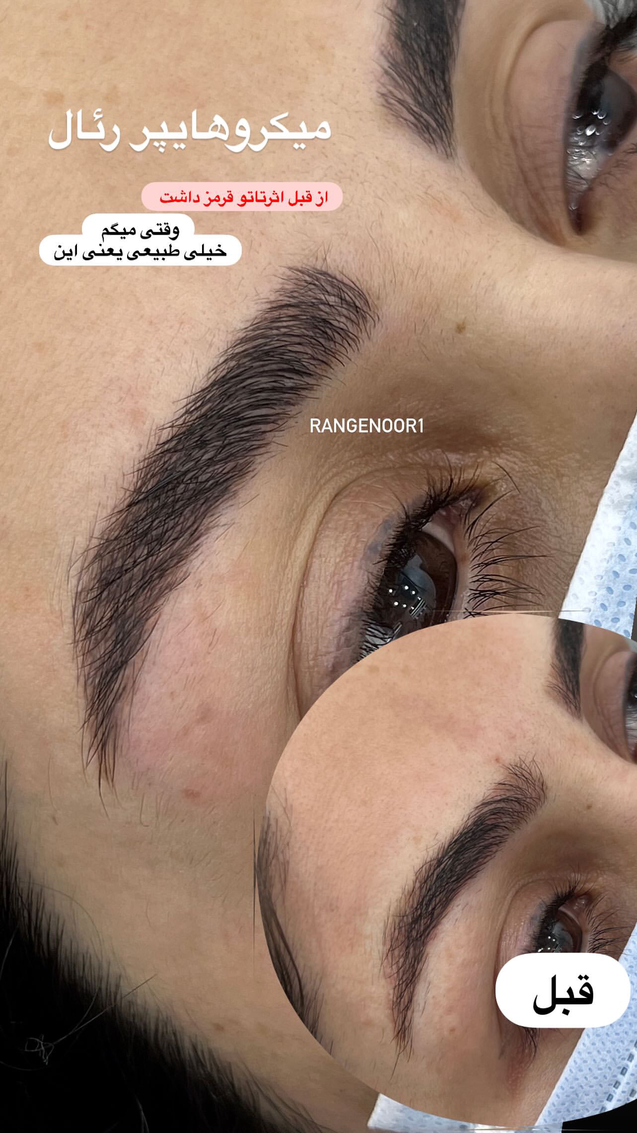 نمونه کار پروانه تقی پور — لیفت و لمینت مژه