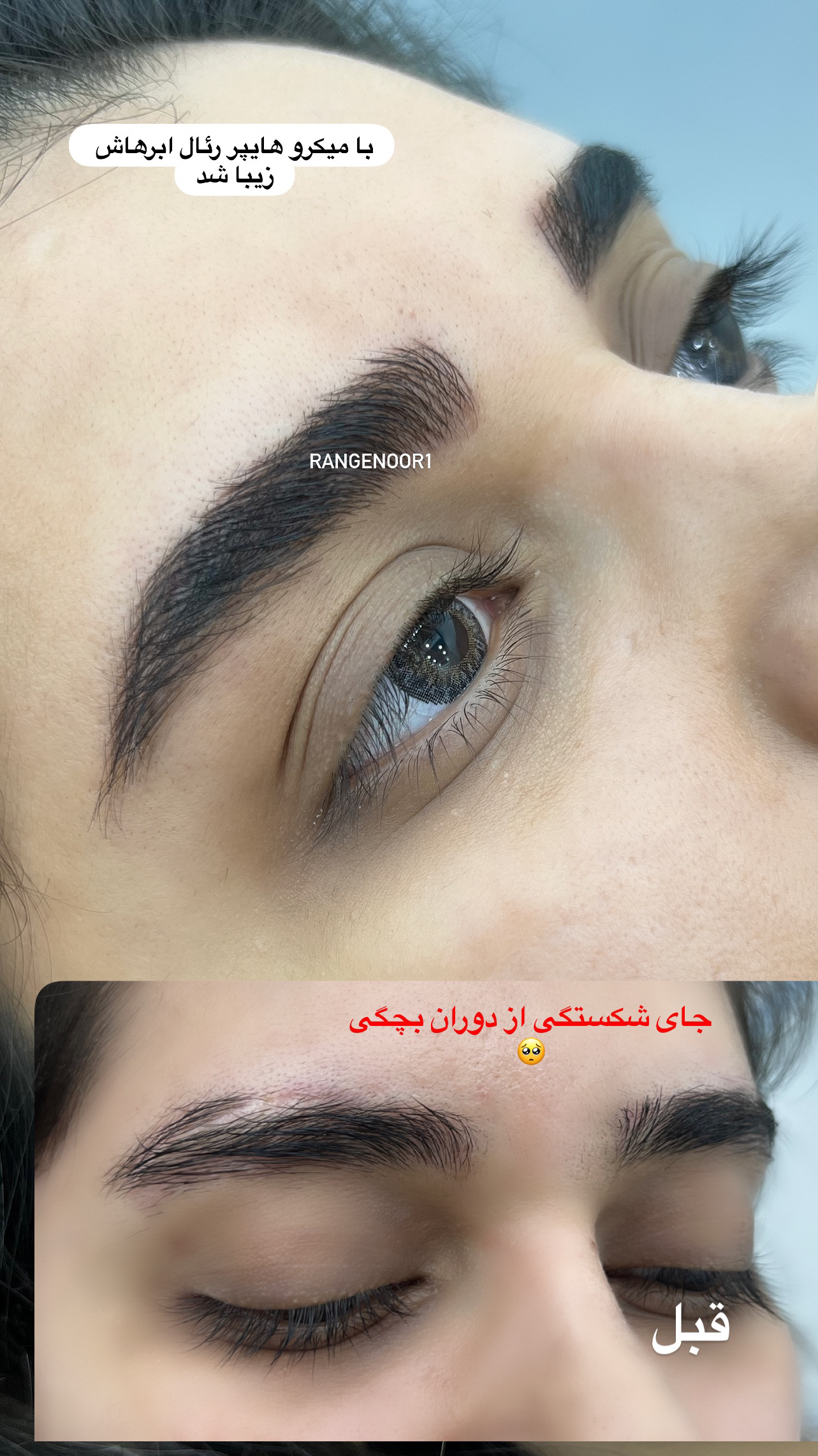 نمونه کار پروانه تقی پور — لیفت و لمینت مژه
