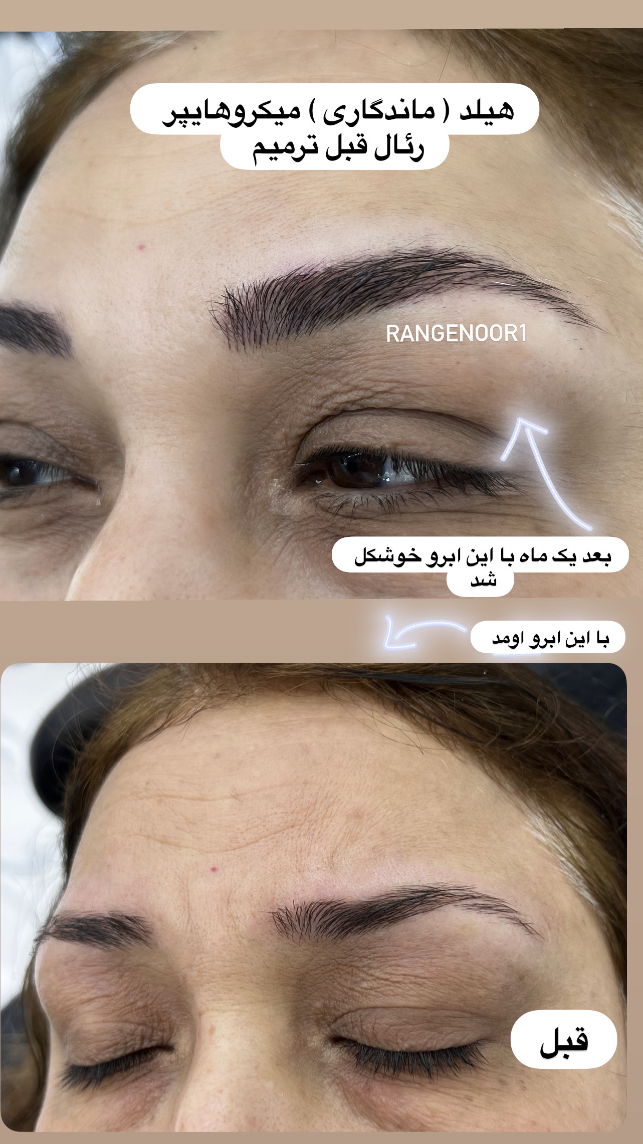 نمونه کار پروانه تقی پور — لیفت و لمینت مژه