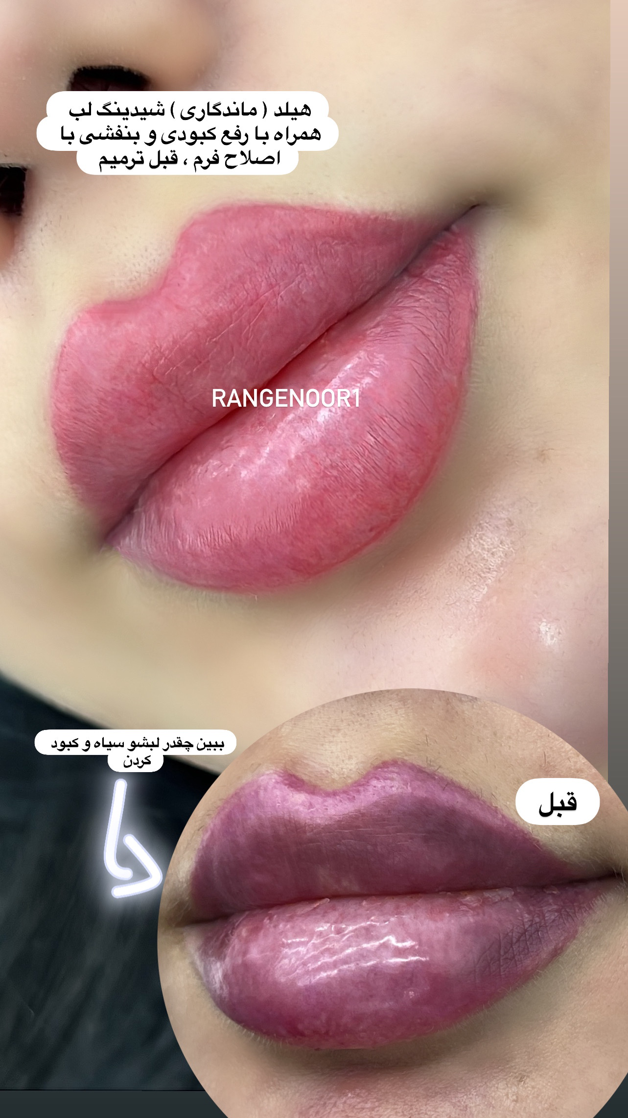 نمونه کار پروانه تقی پور — لیفت و لمینت مژه