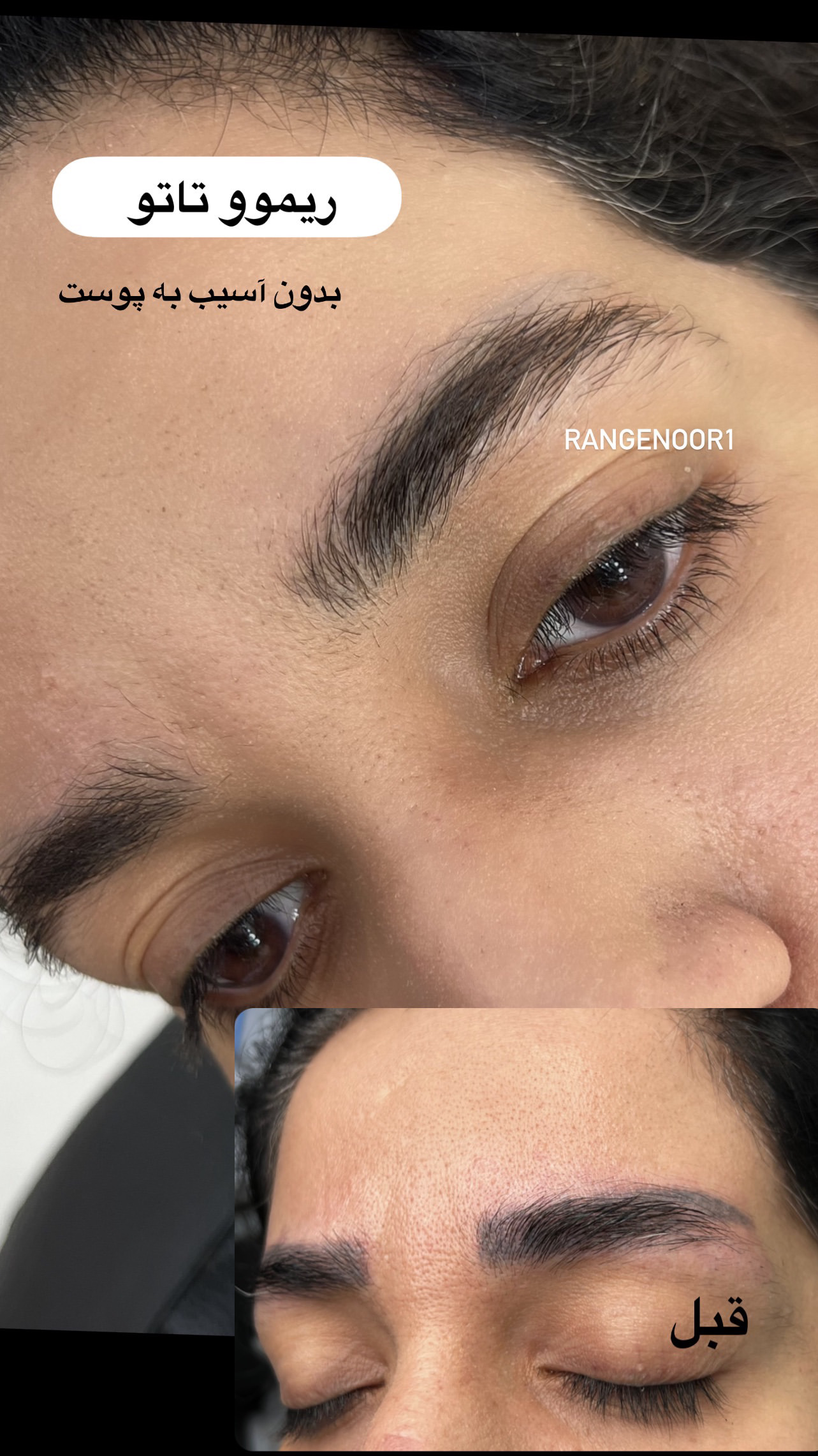 نمونه کار پروانه تقی پور — لیفت و لمینت مژه