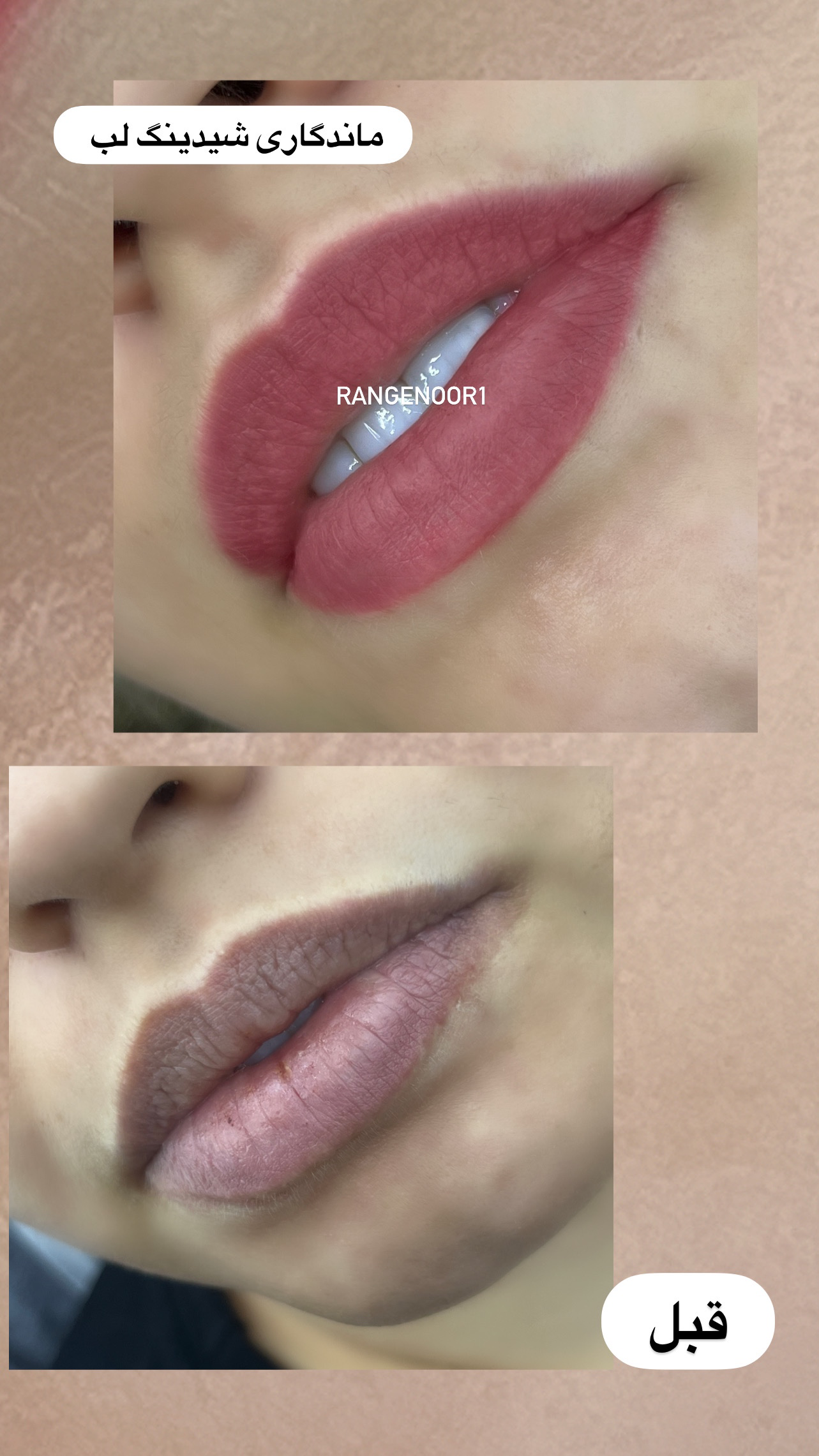 نمونه کار پروانه تقی پور — لیفت و لمینت مژه