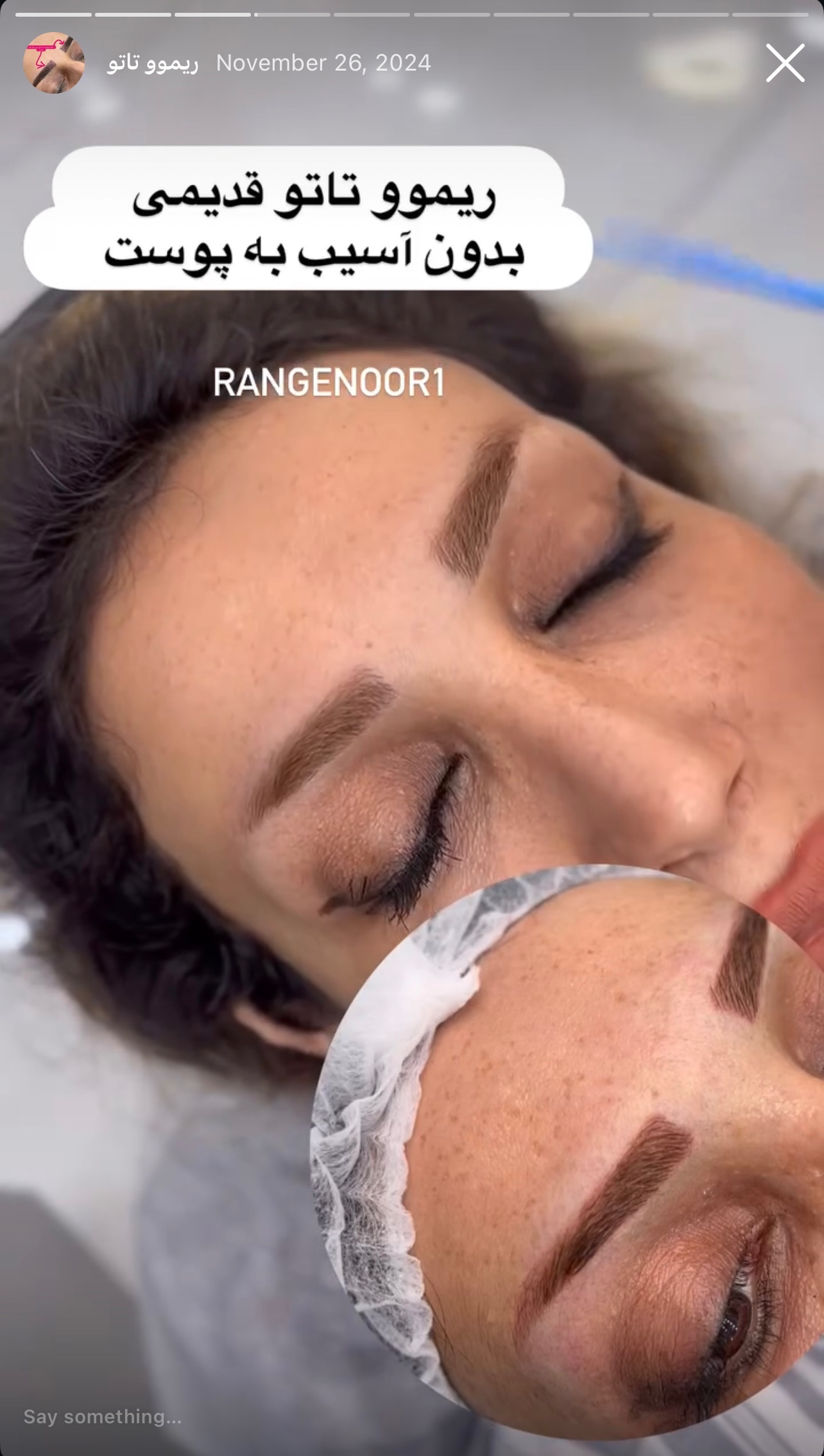 نمونه کار پروانه تقی پور — لیفت و لمینت مژه