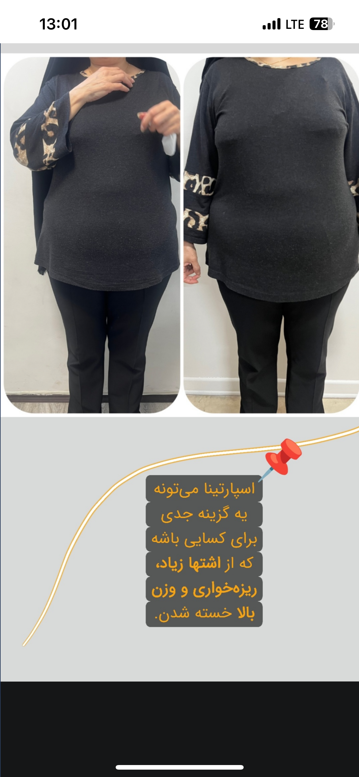 نمونه کار مهشید ذاکری — لیفت و لمینت مژه