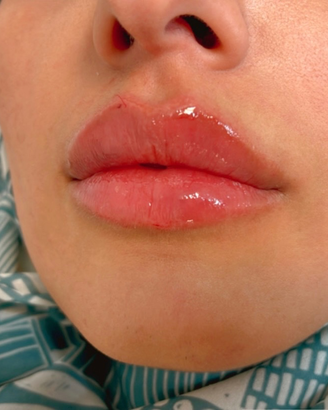 نمونه کار مهشید ذاکری — لیفت و لمینت مژه