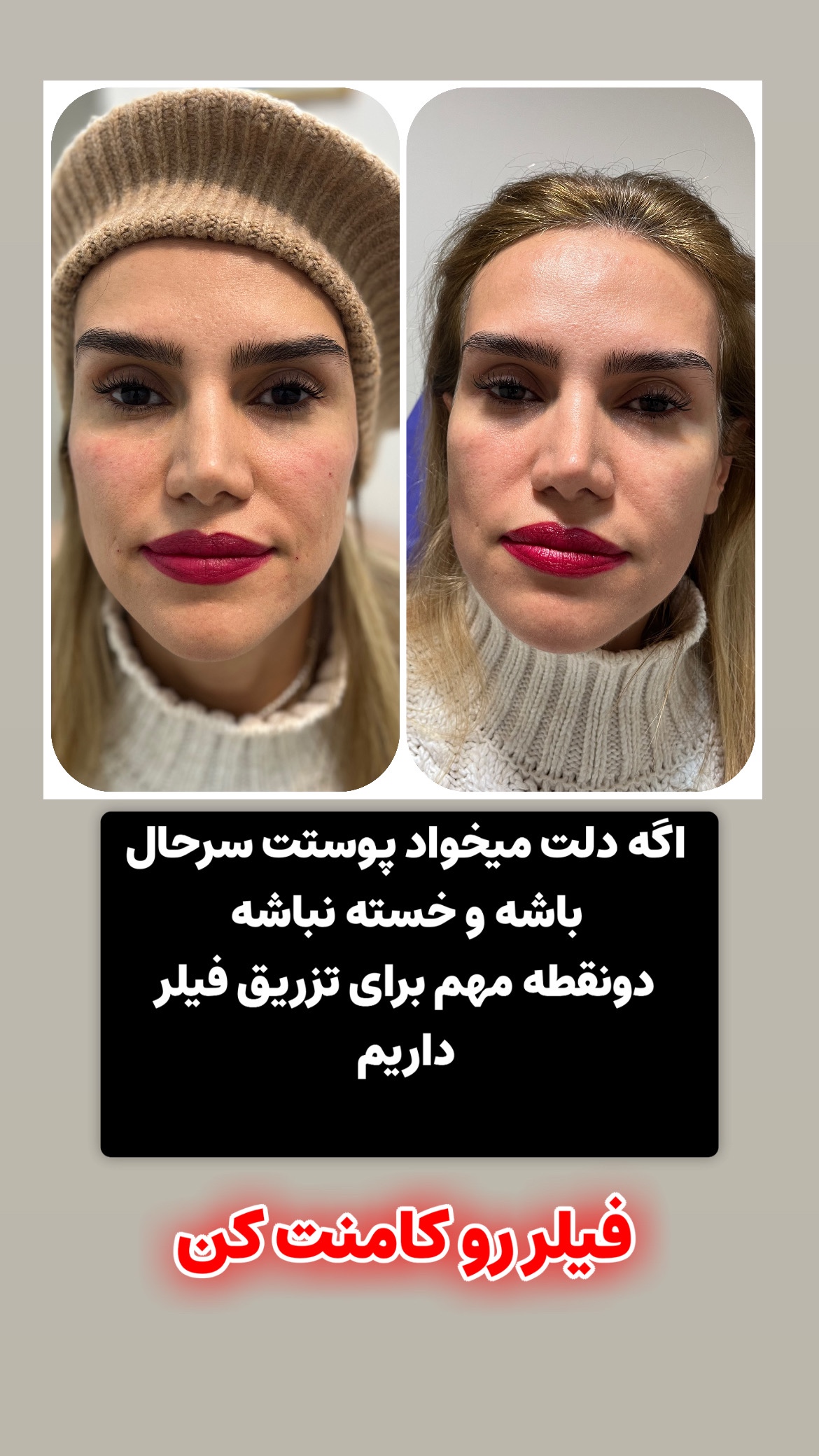 نمونه کار مهشید ذاکری — لیفت و لمینت مژه