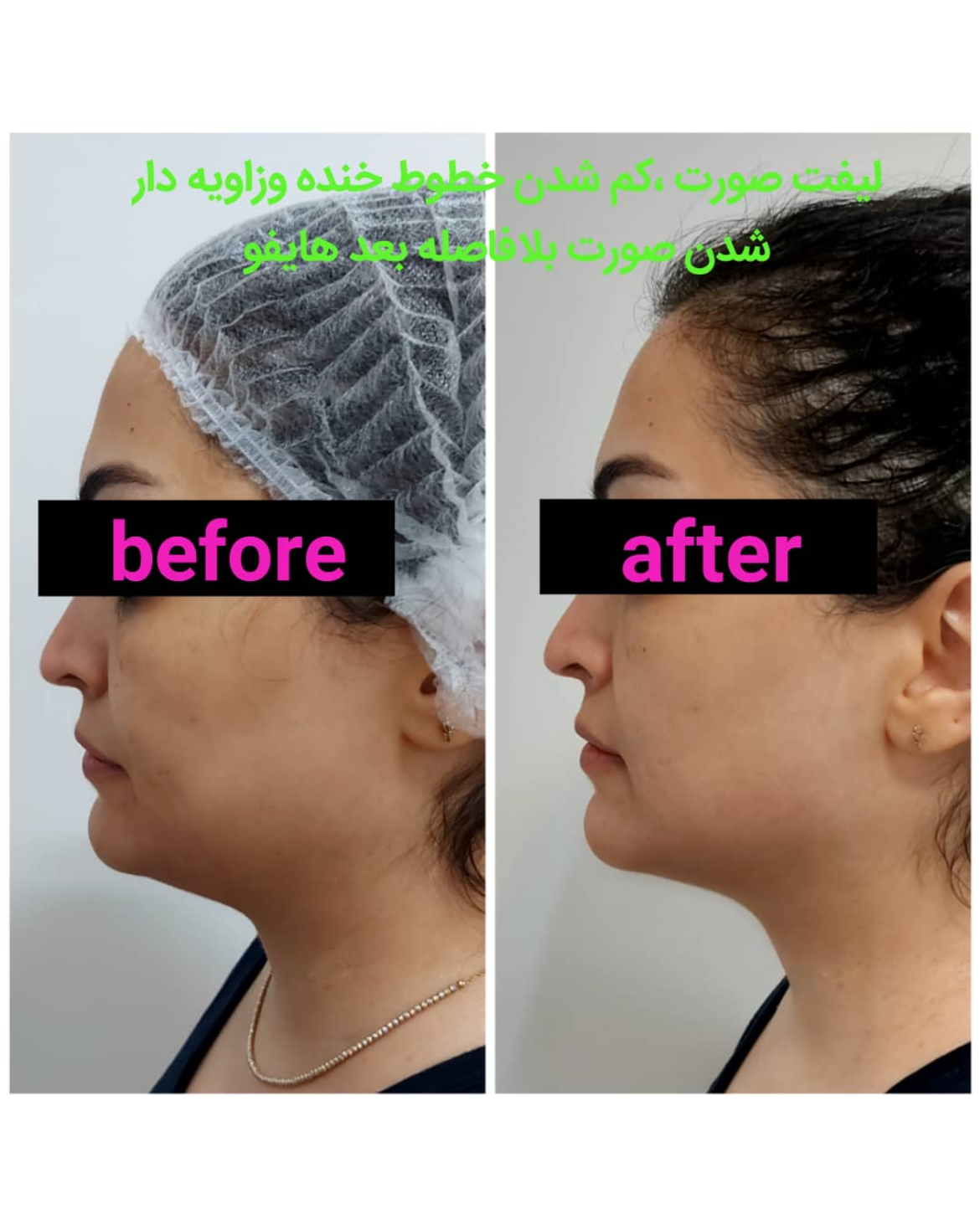 کاور پروفایل مهشید ذاکری — تصویر 1