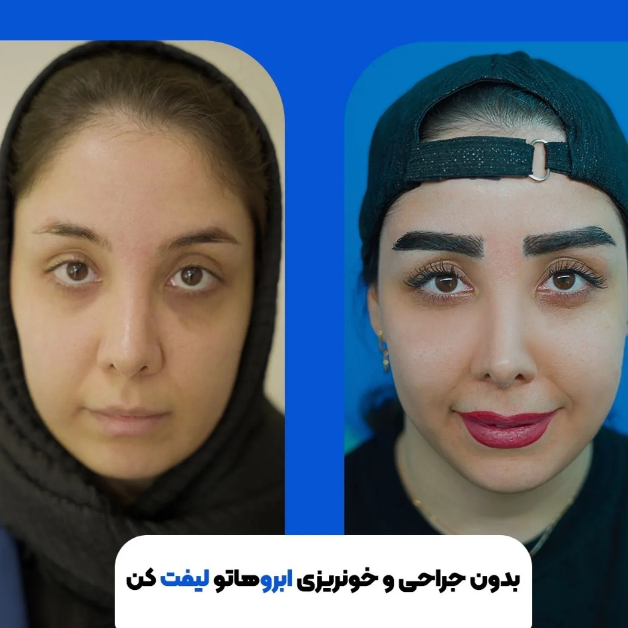 نمونه کار سارا راهنورد — لیفت و لمینت مژه