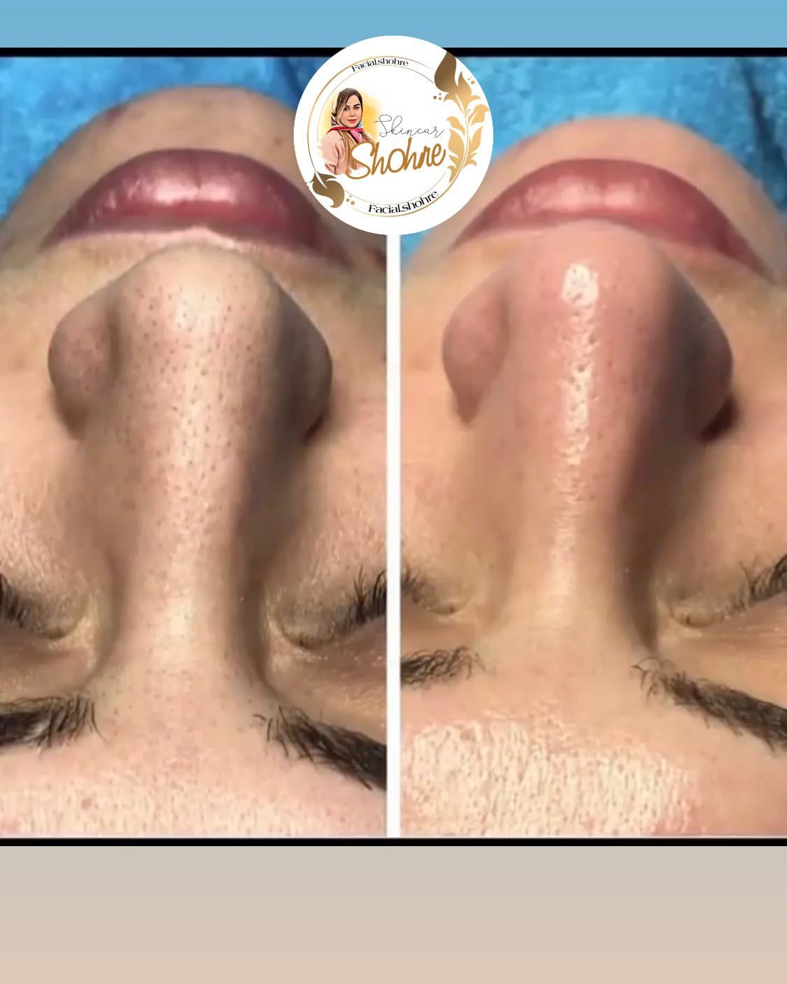 نمونه کار شهره نوروزی — لیفت و لمینت مژه