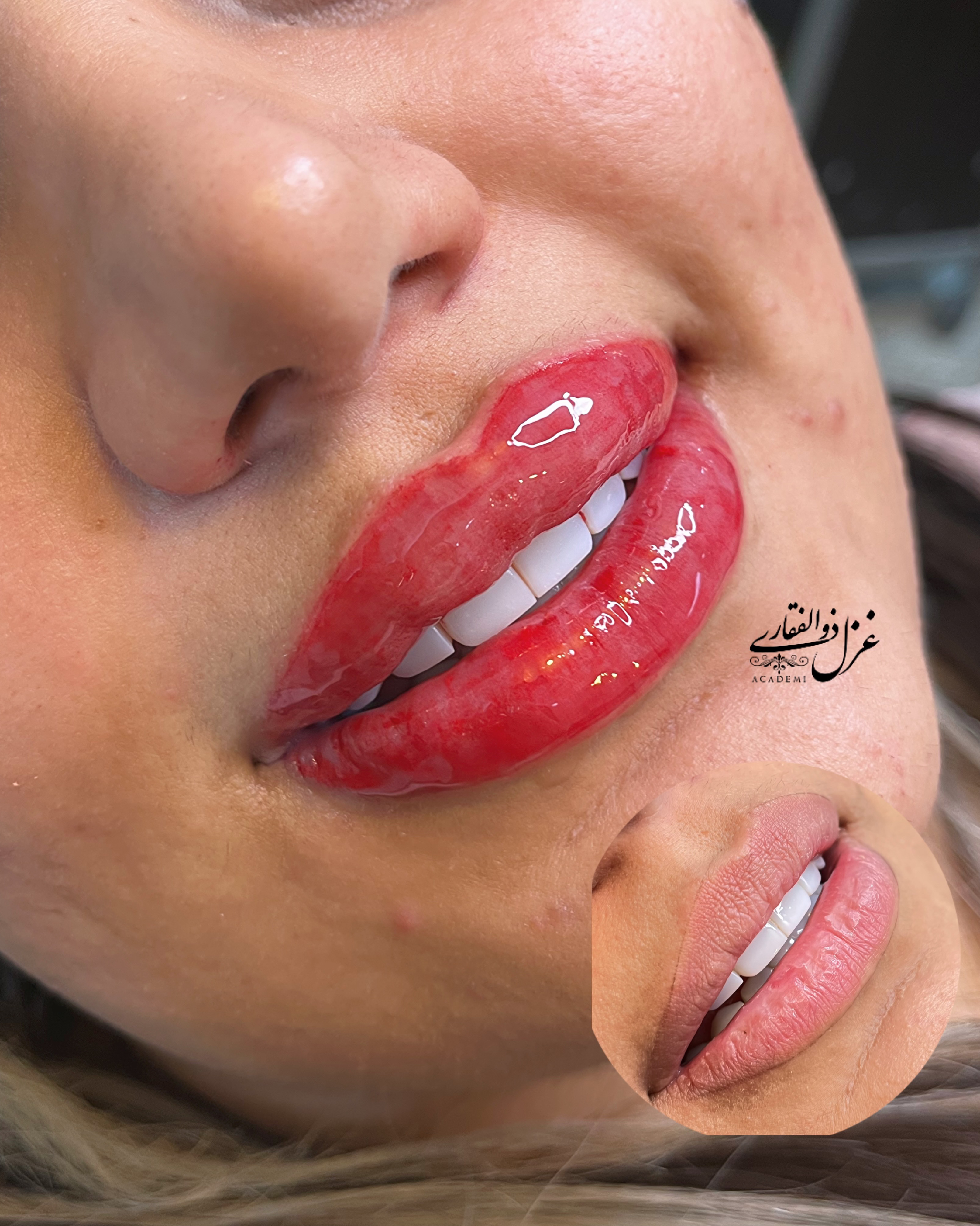 نمونه کار غزل ذوالفقاری — لیفت و لمینت مژه